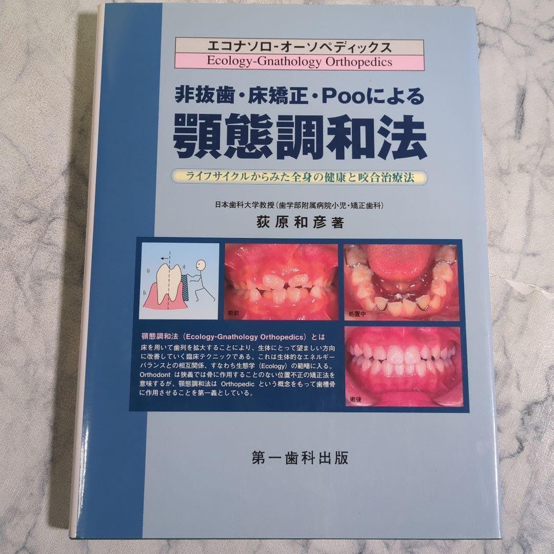 美非抜歯・床・Pooによる顎態調和法