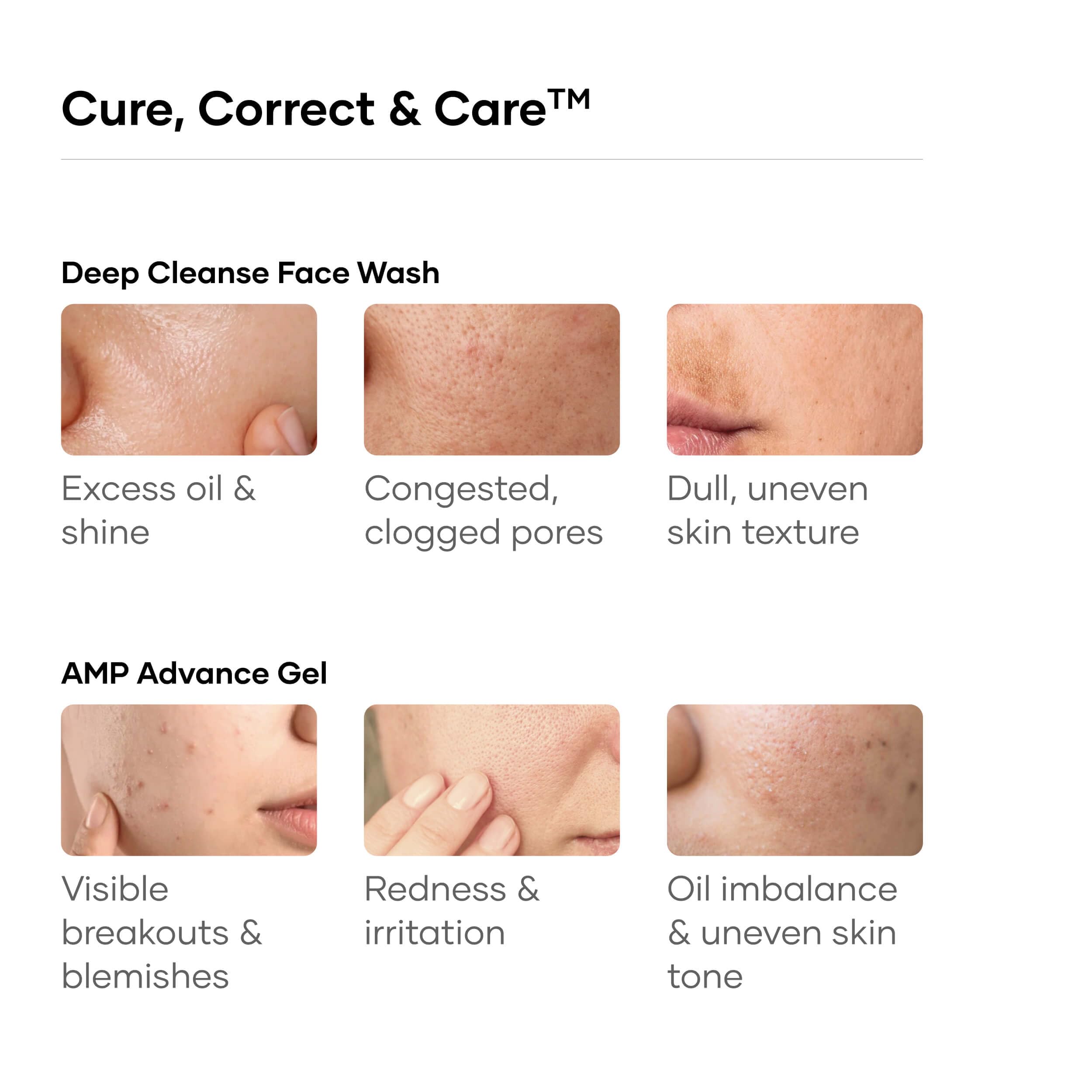 Cureskin Acne Control Combo | Salicylic Acid 2% Deep Cleanse Face Wash 100 ml + AMP Advance Acne Gel 10 g | Clears Pimples, Unclogs Pores & Controls Oil | For Oily & Acne-Prone Skin 1