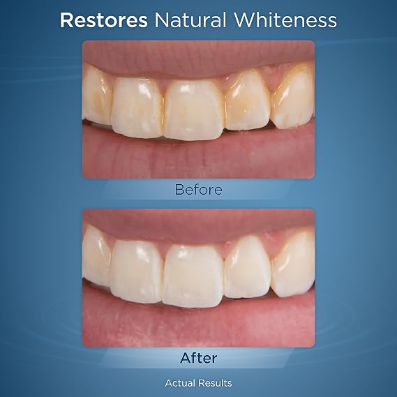 Waterpik Fresh Mint Whitening Refill Tablets (30 Count), Restore Natural Teeth Whiteness, Packaging May Vary, WT-30