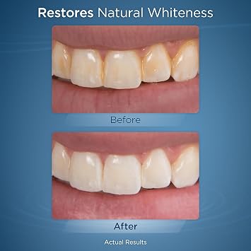 Waterpik Fresh Mint Whitening Refill Tablets (30 Count), Restore Natural Teeth Whiteness, Packaging May Vary, WT-30
