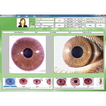 Amazon.co.jp: 虹彩分析カメラ、虹彩診断眼科カメラ、500万画素