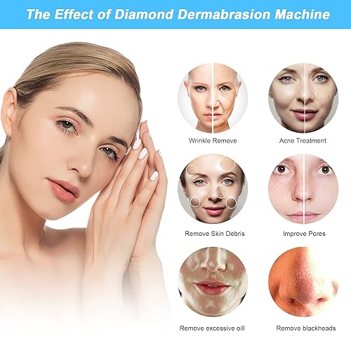 Miniatura 8 de Aimengxi Máquina de microdermoabrasión de diamante 3 en 1 equipo profesional de belleza facial dispositivo de microdermoabrasión con spray al vacío