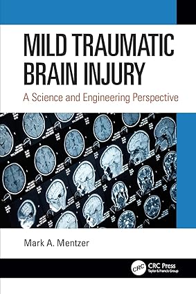 MILD TRAUMATIC BRAIN INJURY A SCIENCE AND ENGINEERING PERSPECTIVE (PB 2021)