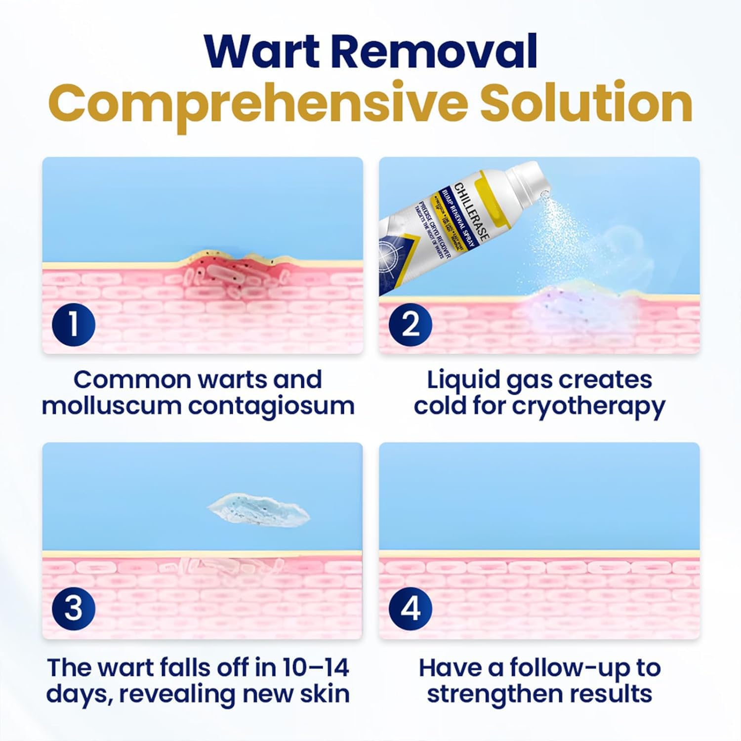 ChillErase Bump Renewal Spray, Soothing and Cooling Formula, Advanced Salicylic Acid Body Spray 2%, Natural Skin Spray-60ml, Suitable for All Skin Types - Image 5