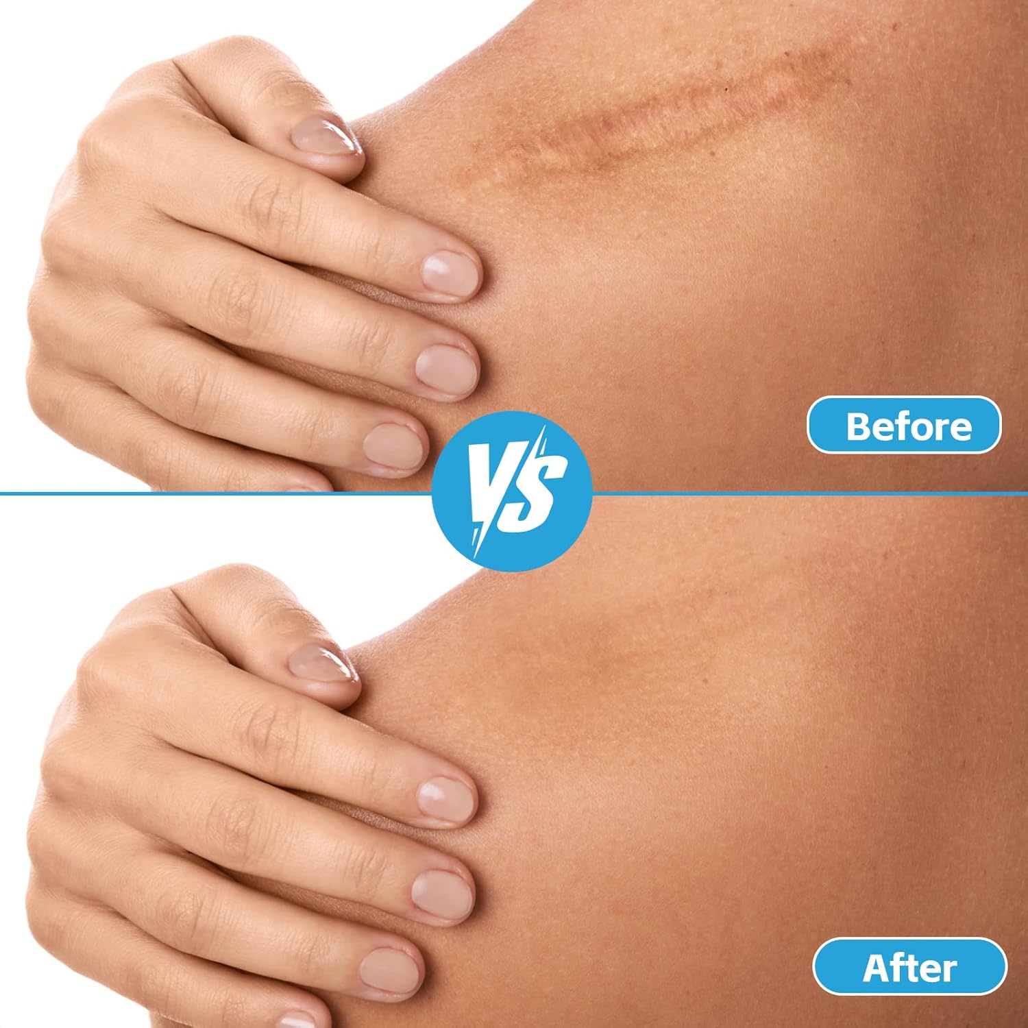 Hydrocolloid Bandages for Wound Care, Extra Large Medical-Grade Hydrocolloid Roll with Self-Adhesive, Ultra Absorbent, Flexible & Waterproof, DIY Size & Shape First Aid Kit Essential (2in*4.8ft) - Image 8