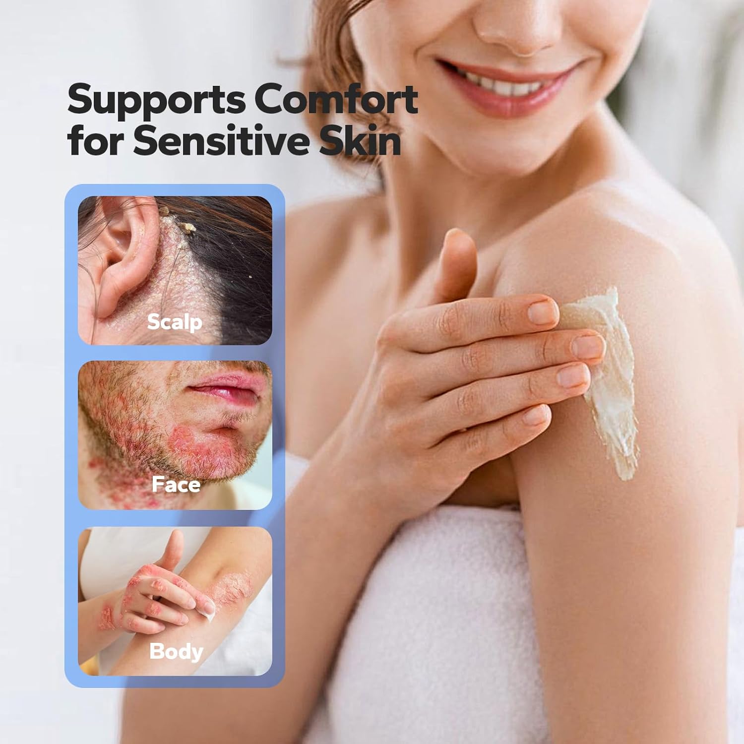 Seborrheic Dermatitis Cream (4.1 Fl Oz), Itch Cream for Flaky, Dry Scalp, Itchy Skin, Eczema Creams for Soothing Relief and Dermatitis Relief, Face, Body & Scalp Moisturizer for Women & Men - Image 2