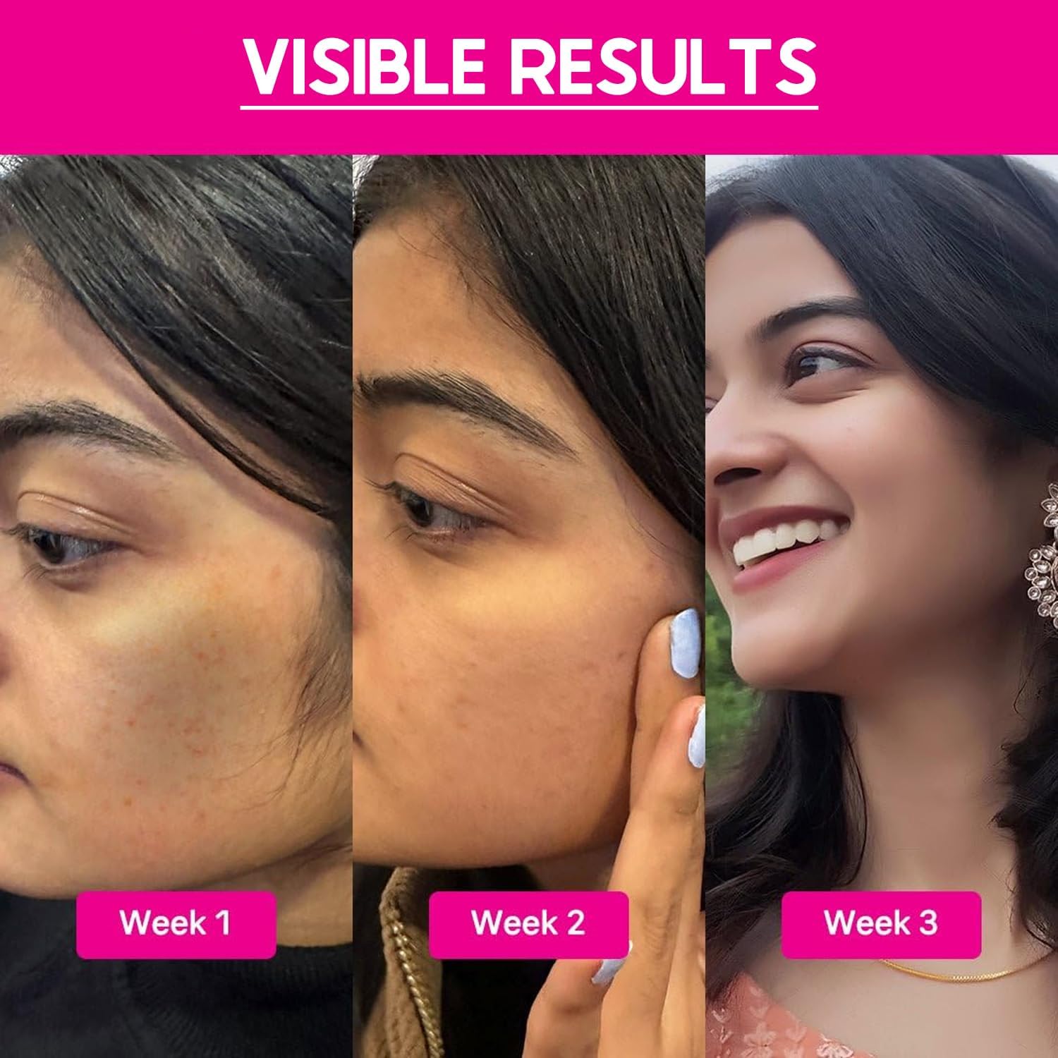 MI Regular Use Exfoliating Peel AHA 15% + PH 5% + BHA 2% Peeling Solution, 30ml | For Glowing Skin, Smooth Texture & Pore Cleansing | Weekend Facial Exfoliator