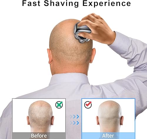 Miniatura 5 de UPTARD Cabezales de repuesto para afeitadora de cabeza, cuchillas de repuesto para afeitadora de cabeza, afeitadoras de cabeza para hombres calvos,