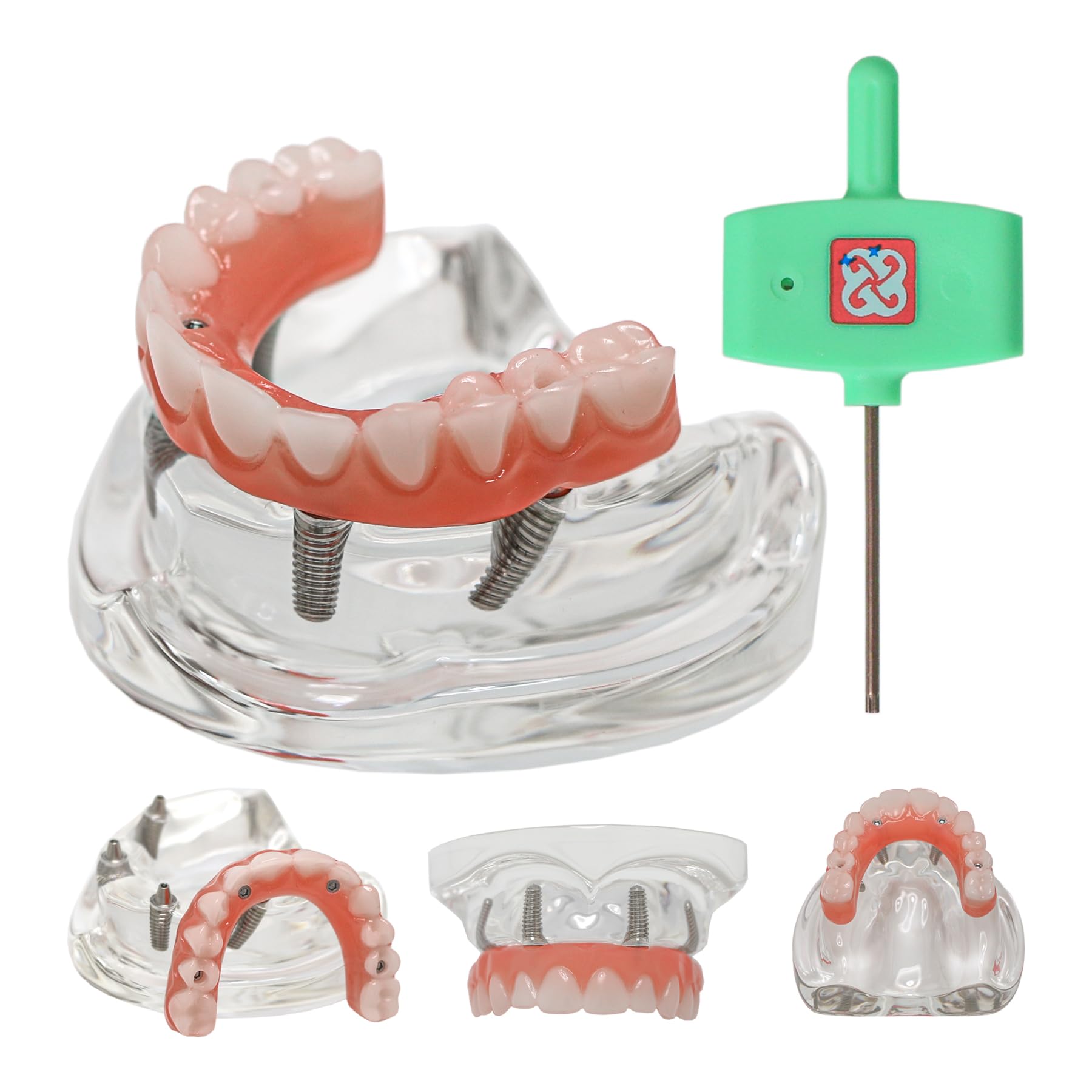 Dental Typodont Implant Restoration Modle All On 4 Overdenture Model Upper Mandible Type Demo Practice Teeth Model with 4 Implants Nails M6001-1
