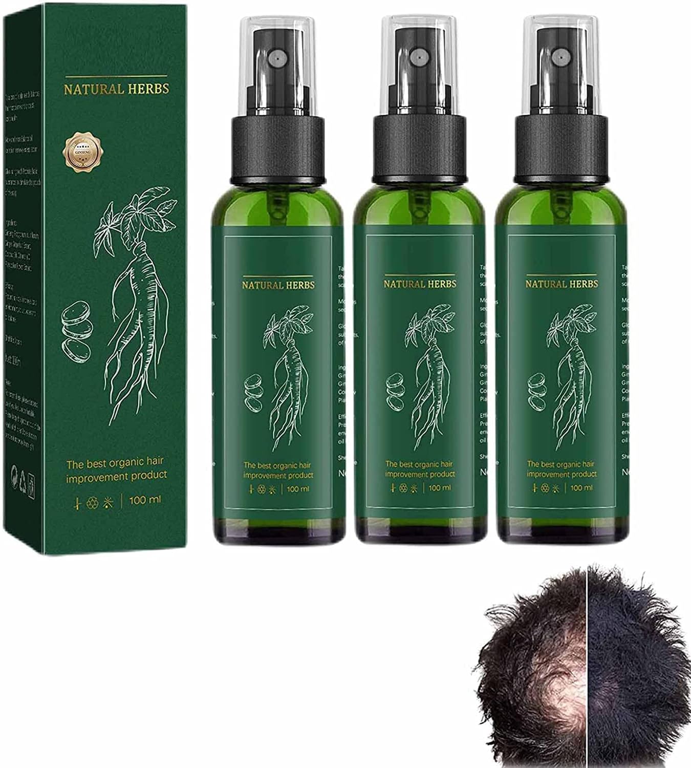 Re Fine Red Ginseng Hairre Generation Spray, Kortin Red Ginseng Hair Regeneration