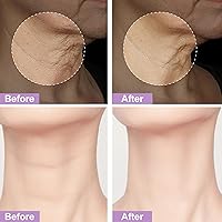 Vista 5 de Crema reafirmante para el cuello que aprieta la piel flácida, crema para el cuello antienvejecimiento, línea fina de arrugas suaves, piel suelta