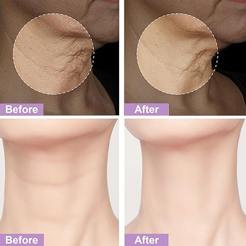 Miniatura 5 de Crema reafirmante para el cuello que aprieta la piel flácida, crema para el cuello antienvejecimiento, línea fina de arrugas suaves, piel suelta