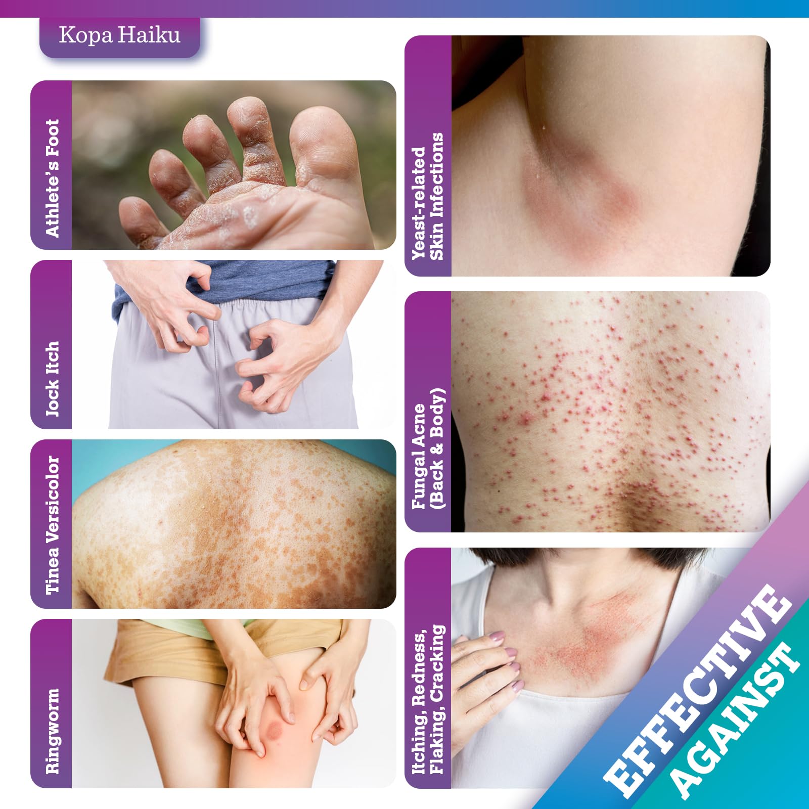 Crema Antimicotica Piedi Pelle Antiprurito: Trattamento Topico per Piedi, Inguine, Ascelle e Pieghe Cutanee – Comfort, Protezione e Igiene Quotidiana