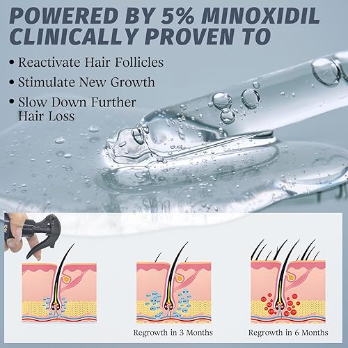 Miniatura 3 de Spray de minoxidil al 5% para el crecimiento del cabello, hombres y mujeres, tratamiento para adelgazamiento y retroceso de la línea del cabello,