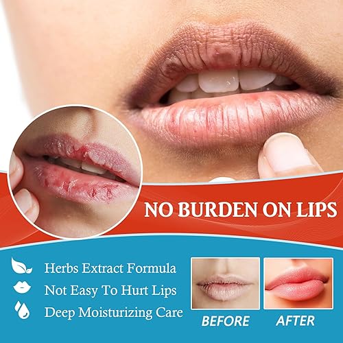 Miniatura 3 de Labios secos agrietados  Bálsamo labial curativo para labios severamente agrietados  Diseñado para hombres, mujeres y niños, crema de tratamiento de