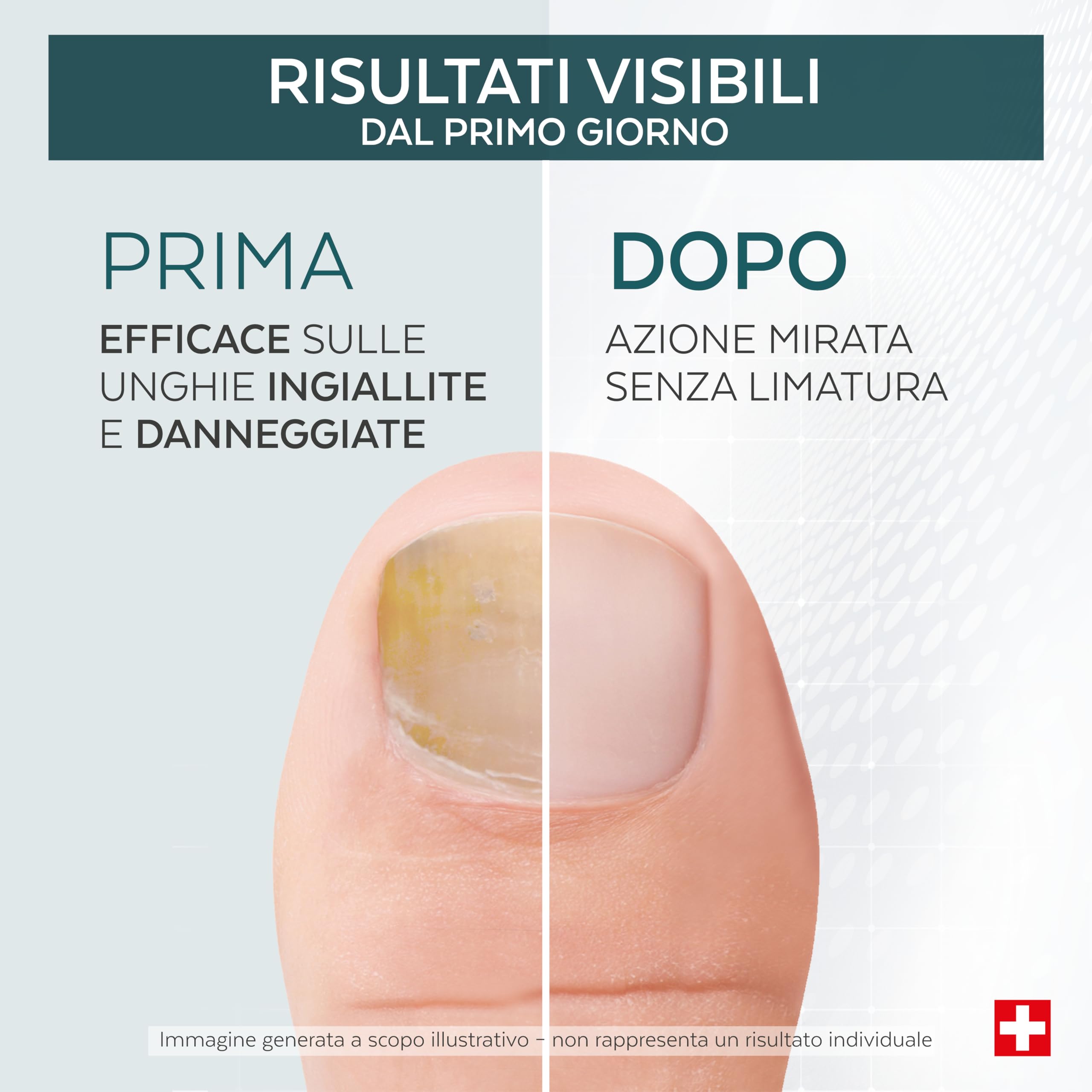 PODERM Tea Tree Riparatore Unghie 6 ml – Siero 4-in-1 | Migliora l’aspetto delle unghie danneggiate, ingiallite e spente – Uniforma lo spessore – Risultati visibili dal primo giorno – Swiss Made