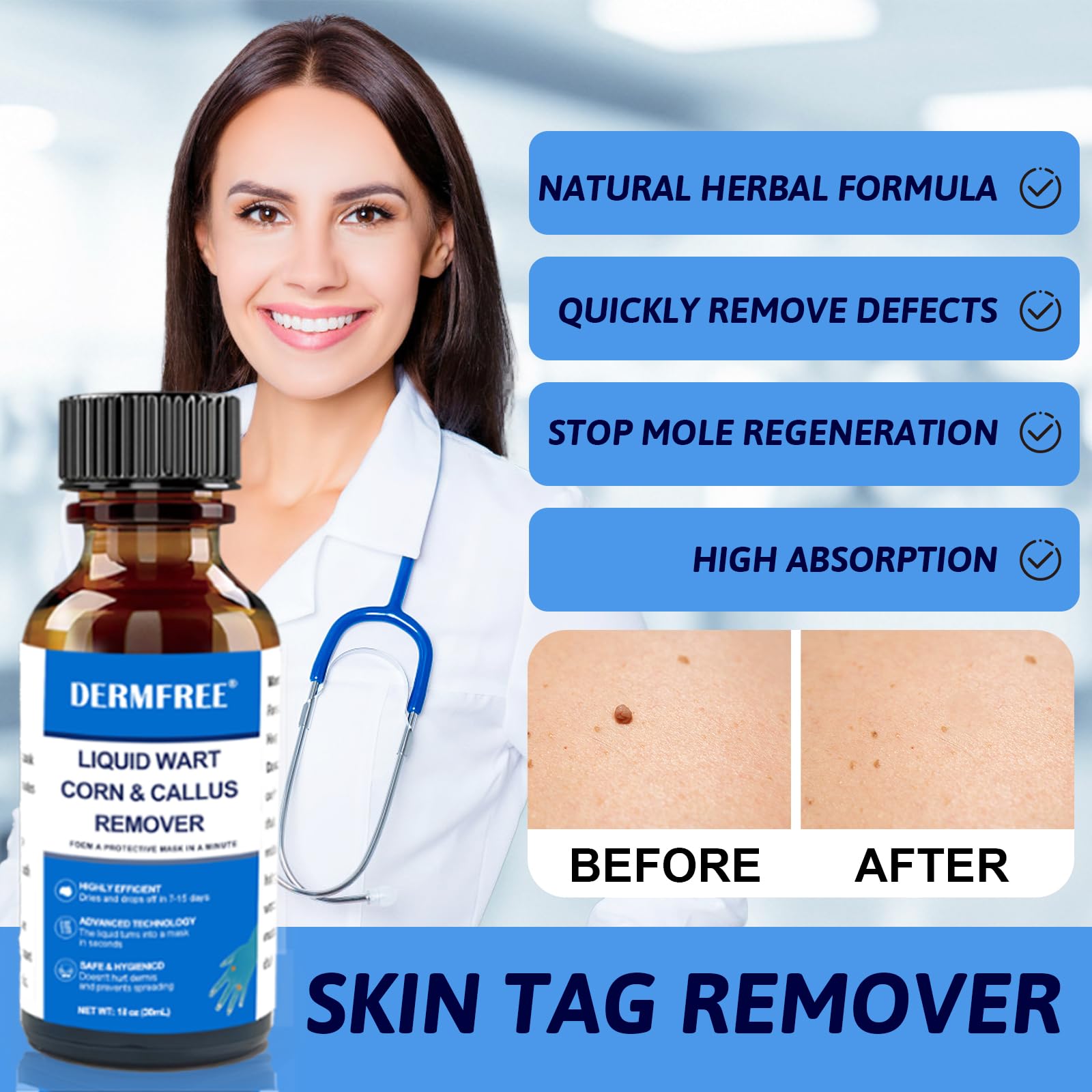 30ml Líquido para Verrugas Corporales y Faciales, Cuidado Exfoliante de la Piel, Cuidado Cutáneo para Manos y Piel
