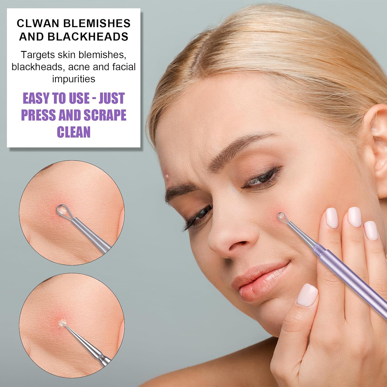 Blackhead Extractor, Metal 2 in 1 Acne Clean Needle Professional Pimple Popper Needle Whitehead Popping Extractor Double-Ended Black Head Remover Comedone Tool for Nose & Face(Purple)