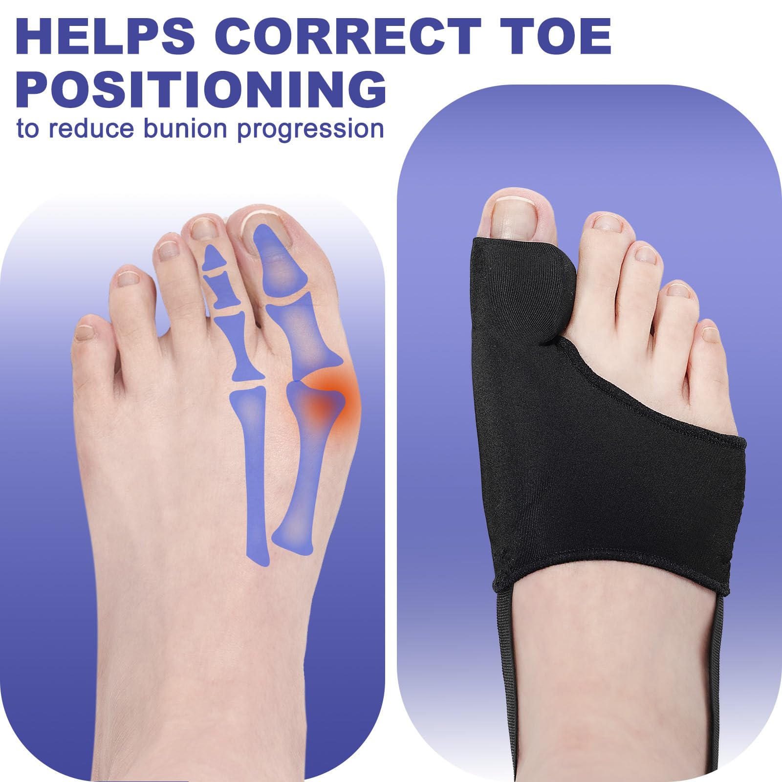 CLEANET 2 Pcs Bunion Corrector for Women & Men Big Toe Straightener-Bunions Correction Splint-Bunion Pads for Bunion Relief-Hallux Valgus Pain Relief,Comfortable & Breathable for Day/Night Support