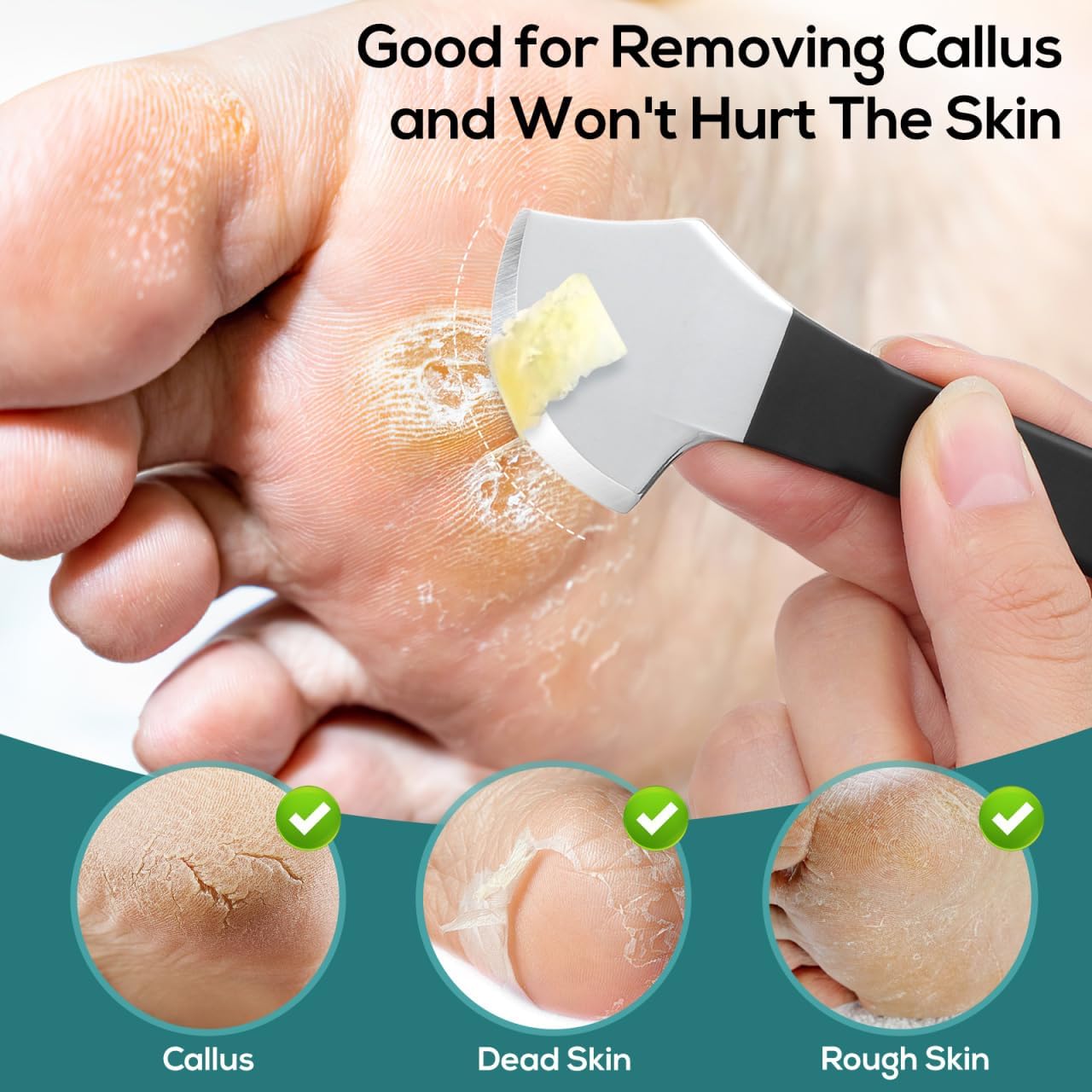 Healifty Pedicure Shaver Foot Corn and Hard Thick Skin Remover Tool Nail File Cuticle Trimmer Heel Scraper for Feet
