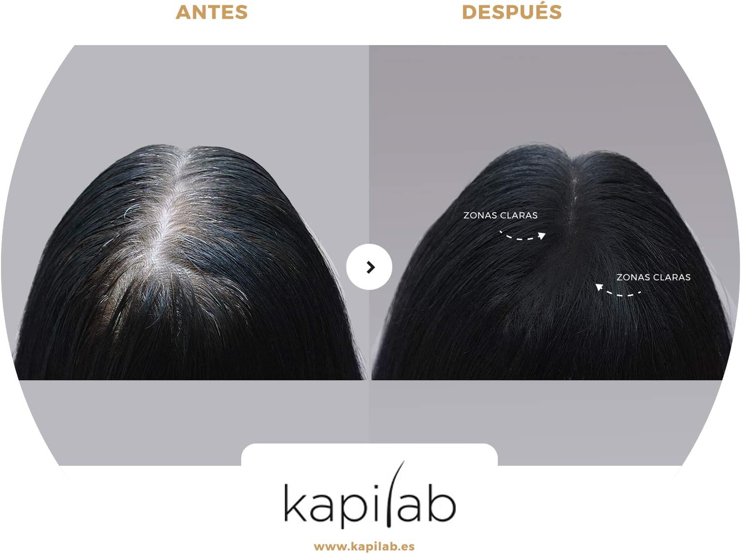 Kapilab Scalp Mask 4g, Medium Brown, Easy to Apply, Natural Look, Keratin Powder, Prevents Hair Loss - Image 5