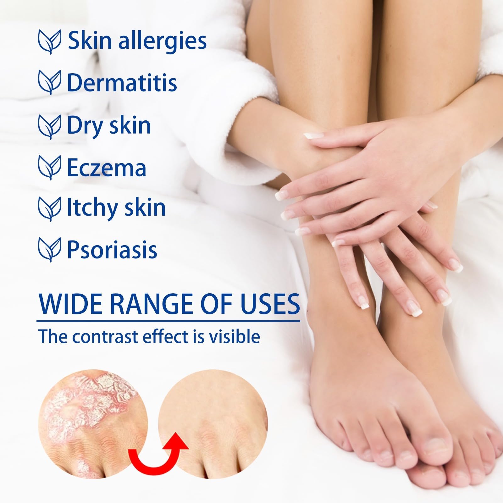 Crèmes Contre Le Psoriasis, Crème à Base De Plantes, Pour le Corps, creme intense, Apaise les Cutanées, Soulagement efficace des démangeaisons Le Pour Réduit Des Démangeaisons