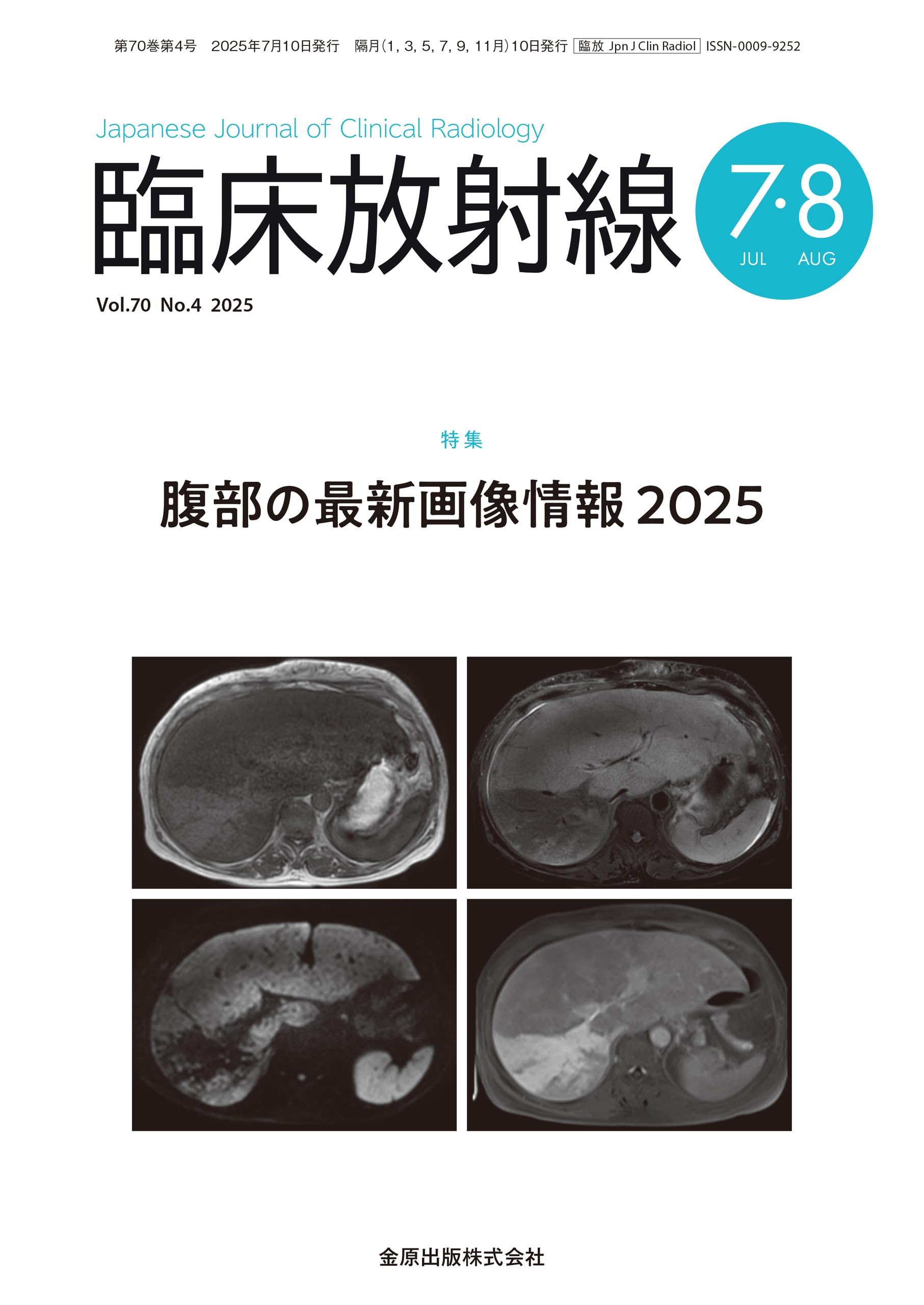 放射線医学大系 （25 A）（大型本） 臨床放射線 2025年7・8月号 腹部の最新画像情報2025 | 金原出版