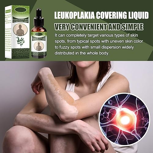 Miniatura 4 de Crema de vitíligo, ungüento para tratamiento de vitíligo para mejorar la pigmentación de la piel y reducir la leucoplasia cubierta segura portátil