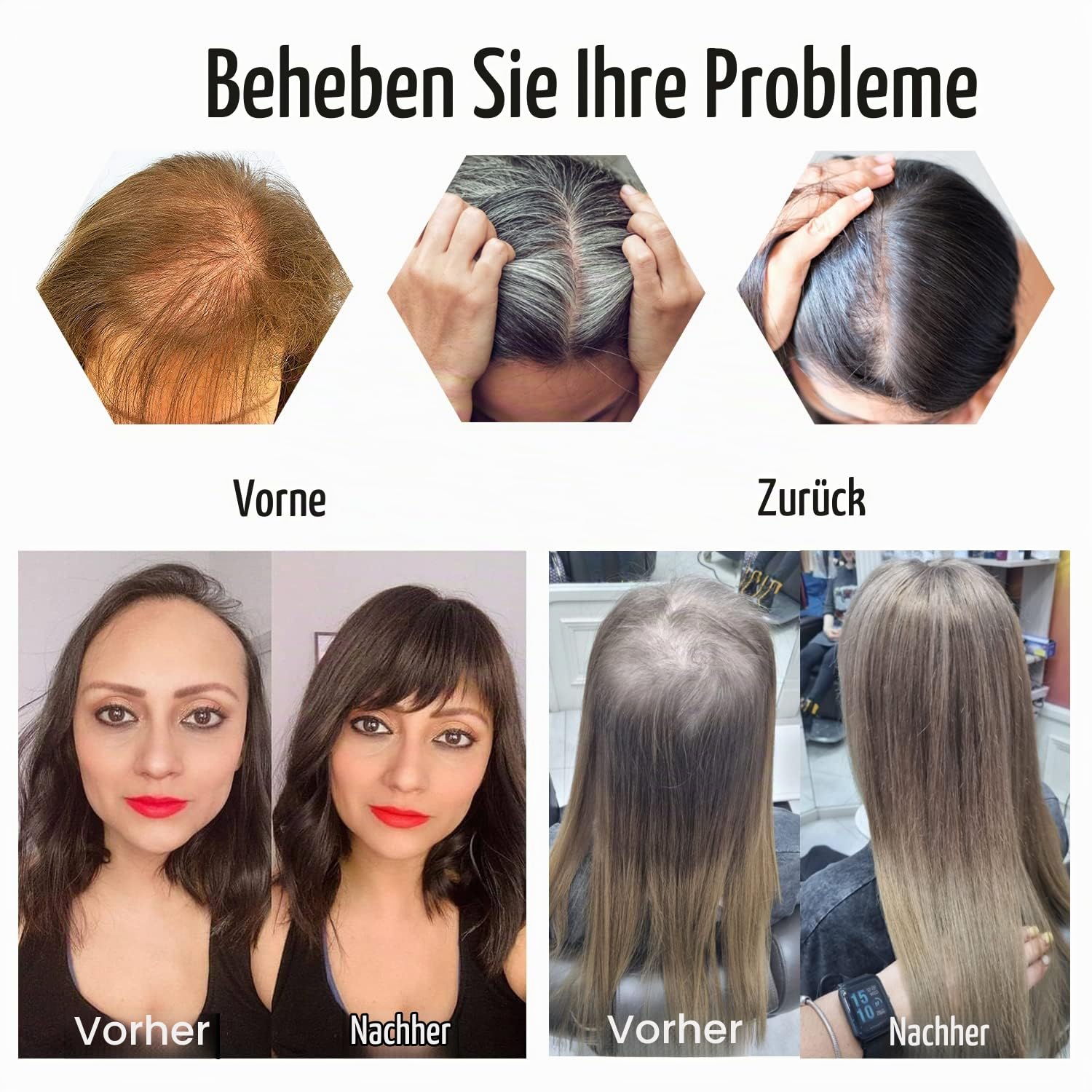 Originea Echthaar Topper Für Frauen Dünner Werdendes Haar 150% Dichte Clip in Topper Echthaar Extensions 14x15cm Mono Basis Handgefertigt Toupet mit Spitzenfront 40cm-80g #P18/613