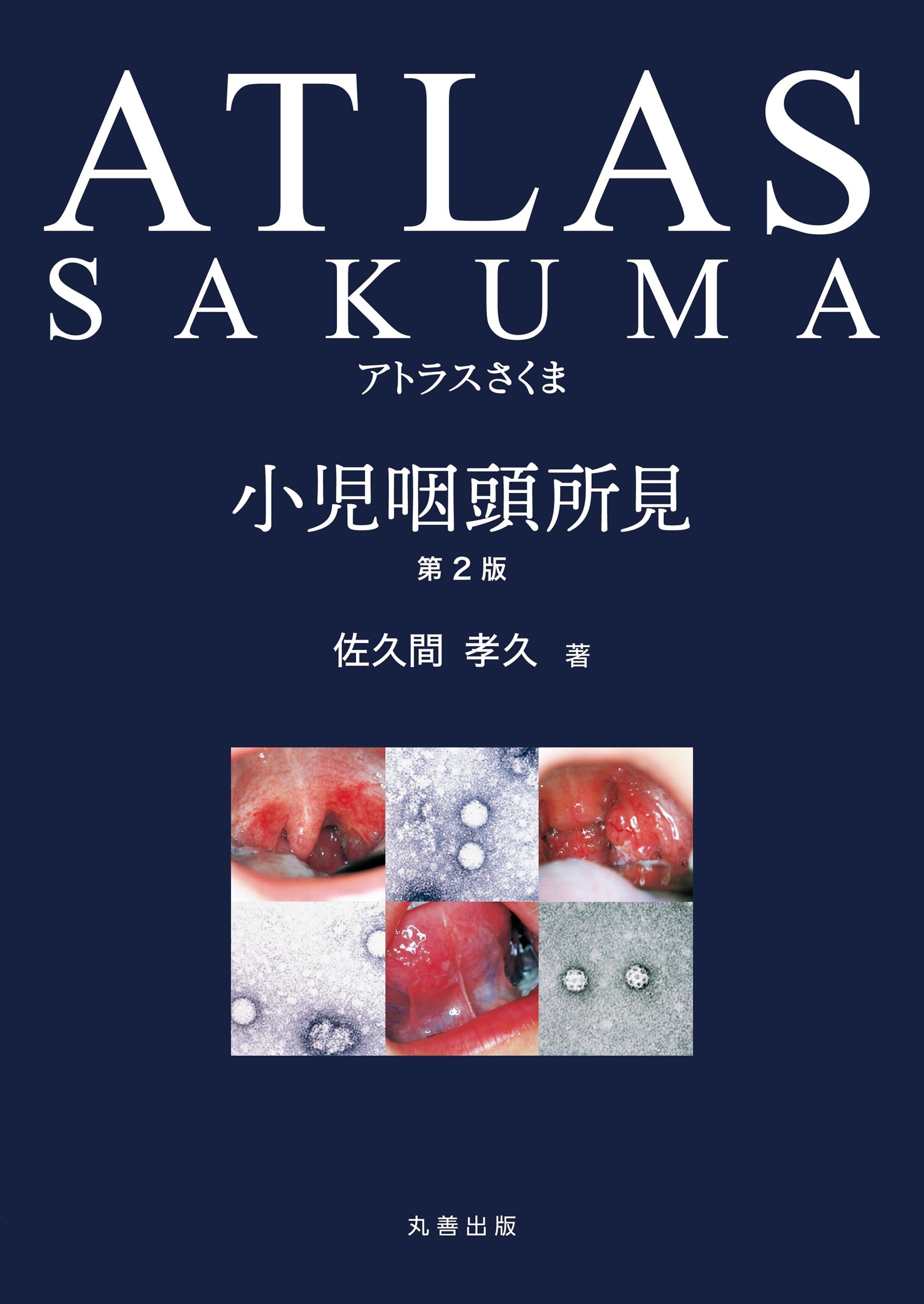ATLAS SAKUMA 小児咽頭所見 Amazon.co.jp: アトラスさくま 小児咽頭所見 第2版 : 佐久間 孝久: 本