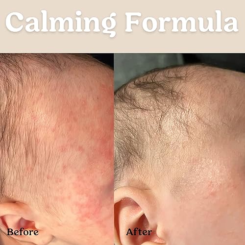 Miniatura 6 de Roe Wellness Aceite para el cabello, el cuero cabelludo y el cuerpo sin perfume Masajear, calmar e hidrata la piel irritada Hidratante natural no