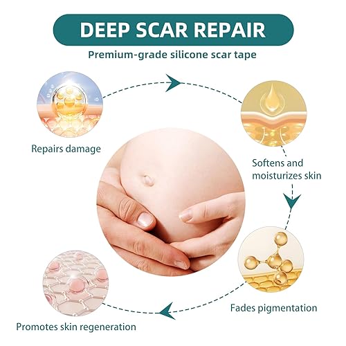 Miniatura 3 de Cinta de silicona para cicatrices quirúrgicas láminas de gel de cicatrices de grado médico para recuperación y tratamiento de abdominoplastia de