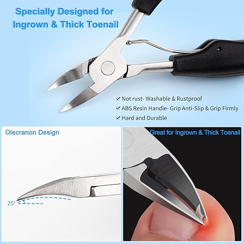 Miniatura 2 de Cortaúñas para uñas gruesas y encarnadas, herramienta de uñas encarnadas con 100 parches de corrección de uñas de los pies, kit de eliminación de