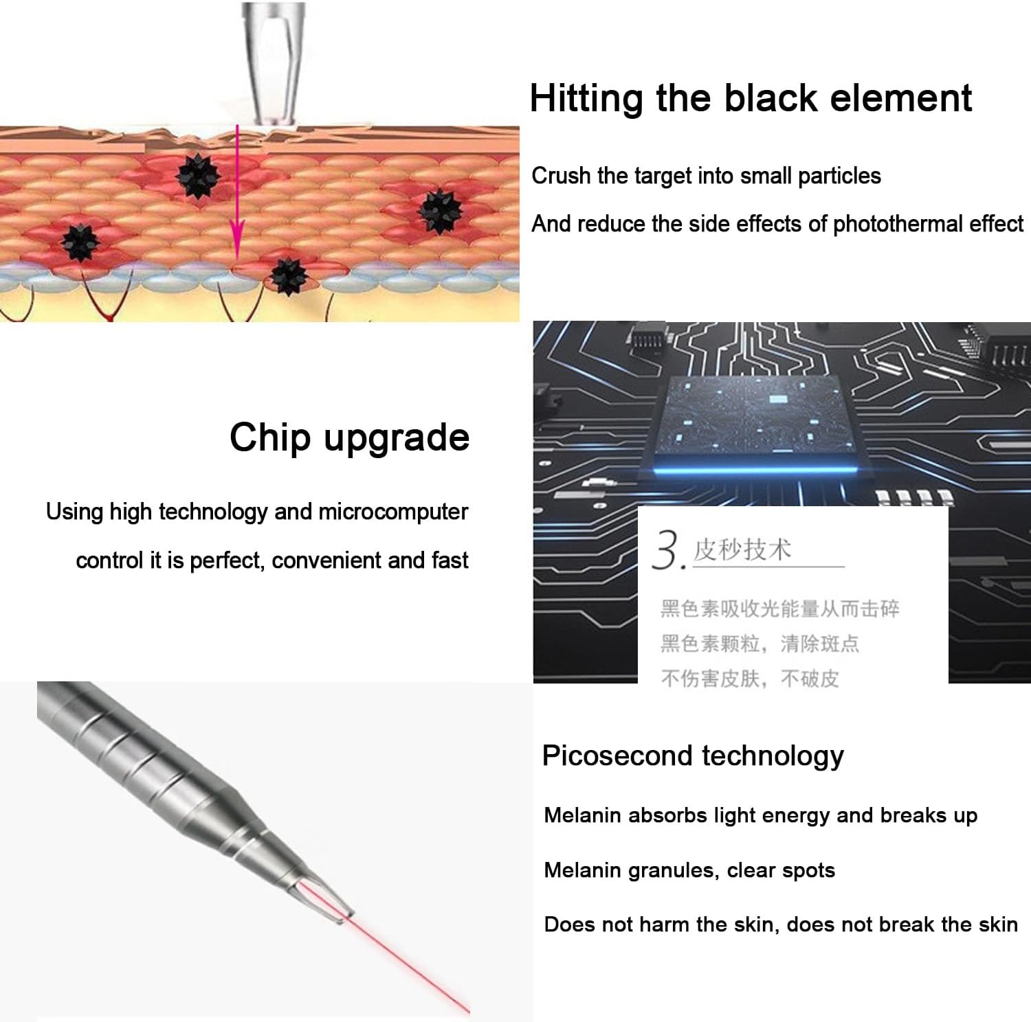 Illustrations explaining the picosecond laser technology: how it breaks down pigment particles, the chip upgrade for control, and the non-damaging effect on skin.