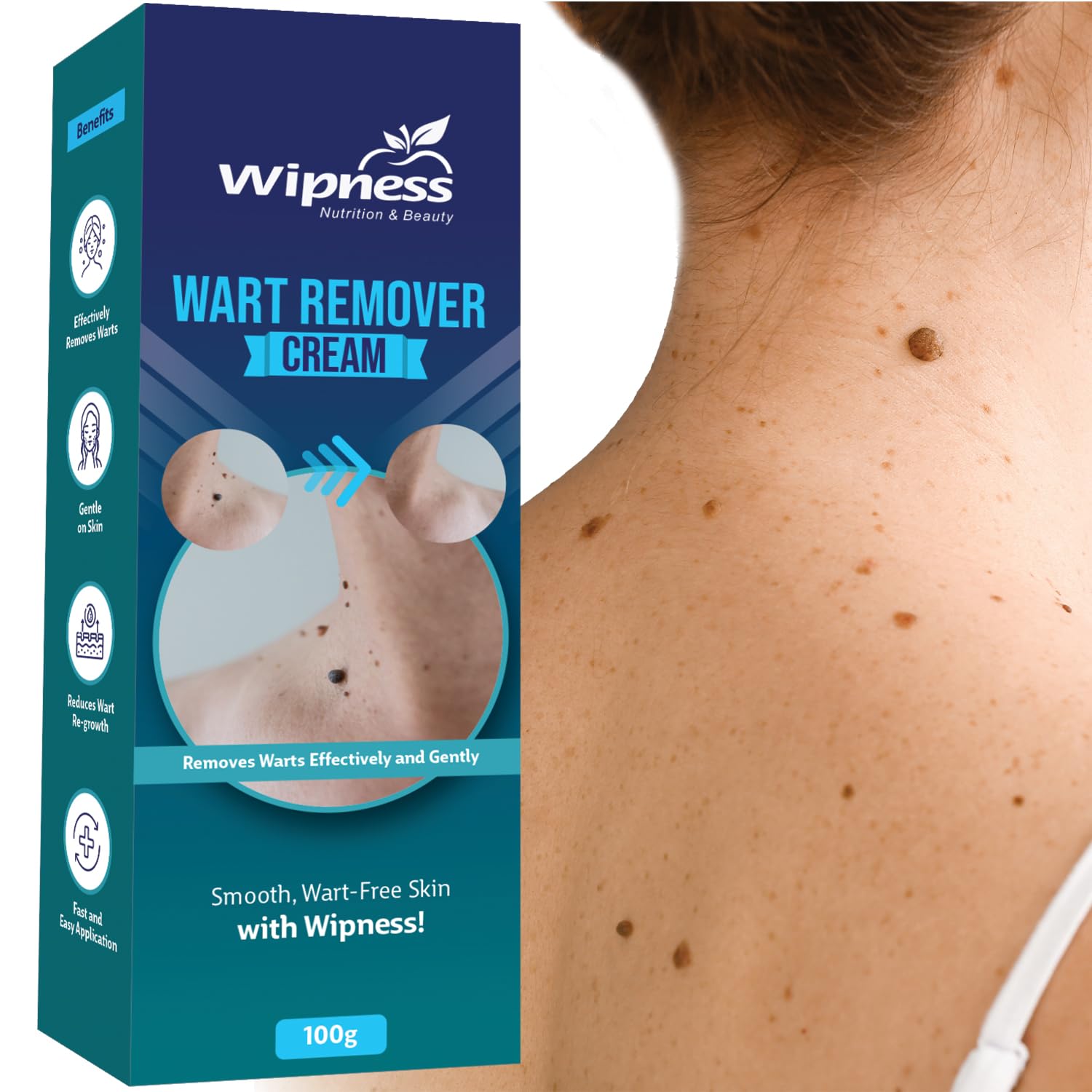 Wipness Wart Remover Cream for Men & Women – 100 Gram (Pack of 1-100 GM) (B0DH2PKTTS) Amazon Price History, Amazon Price Tracker