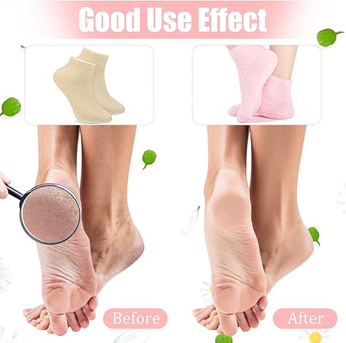 Miniatura 4 de Janmercy 3 pares de calcetines de aloe hidratante con infusión de gel para dormir, pies secos y peludos, calcetines de loción antideslizantes para