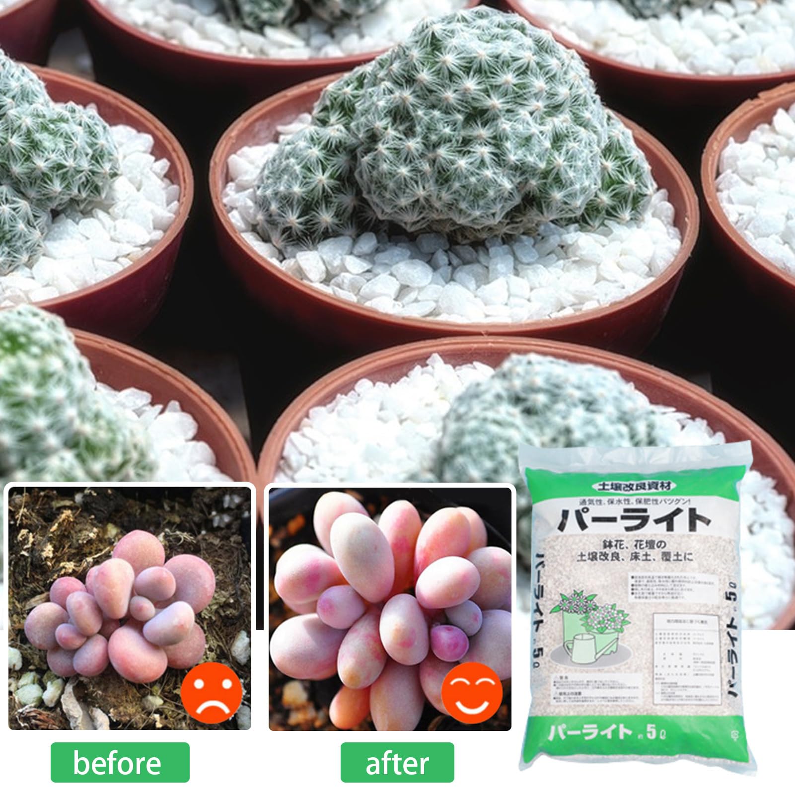 Gartenbau Perlit, Perlitpflanzer -Boden -Additiv - Innenboden Perlit 5 L Für Pflanzen, Perlit Für Innenpflanzen Mit Hervorragender Isolierung Zum Start Von Pflanzen,Pflanzen Perlite, Gartenbau Perlite