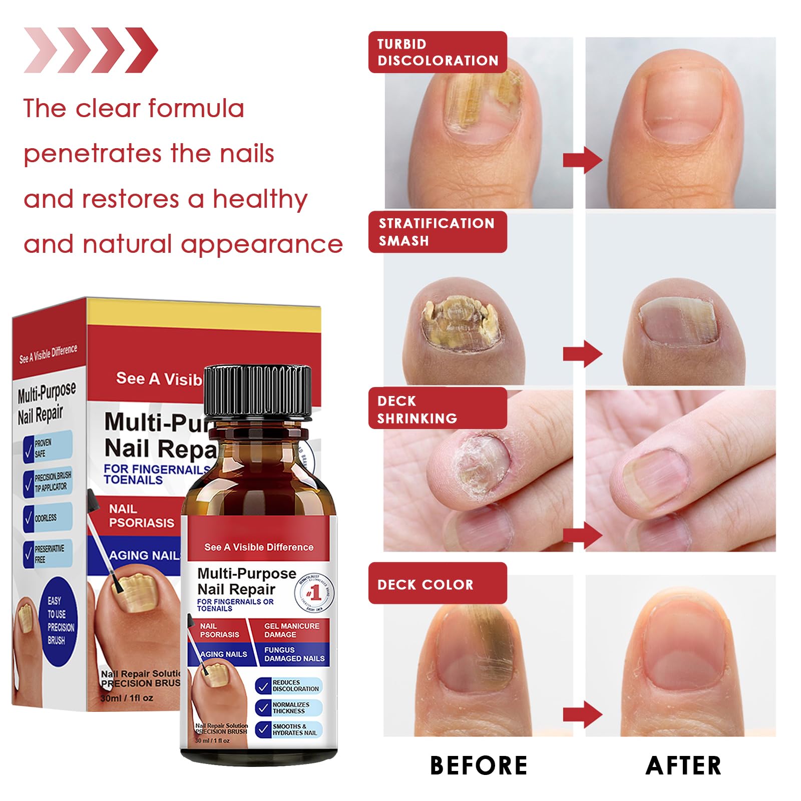 30ml Riparazione Unghie,Soluzione per la Cura delle Unghie,Liquido Cura unghia,per Migliorare l'Aspetto delle Unghies e Rinforzare la Struttura dell'Unghia,Uso Quotidiano