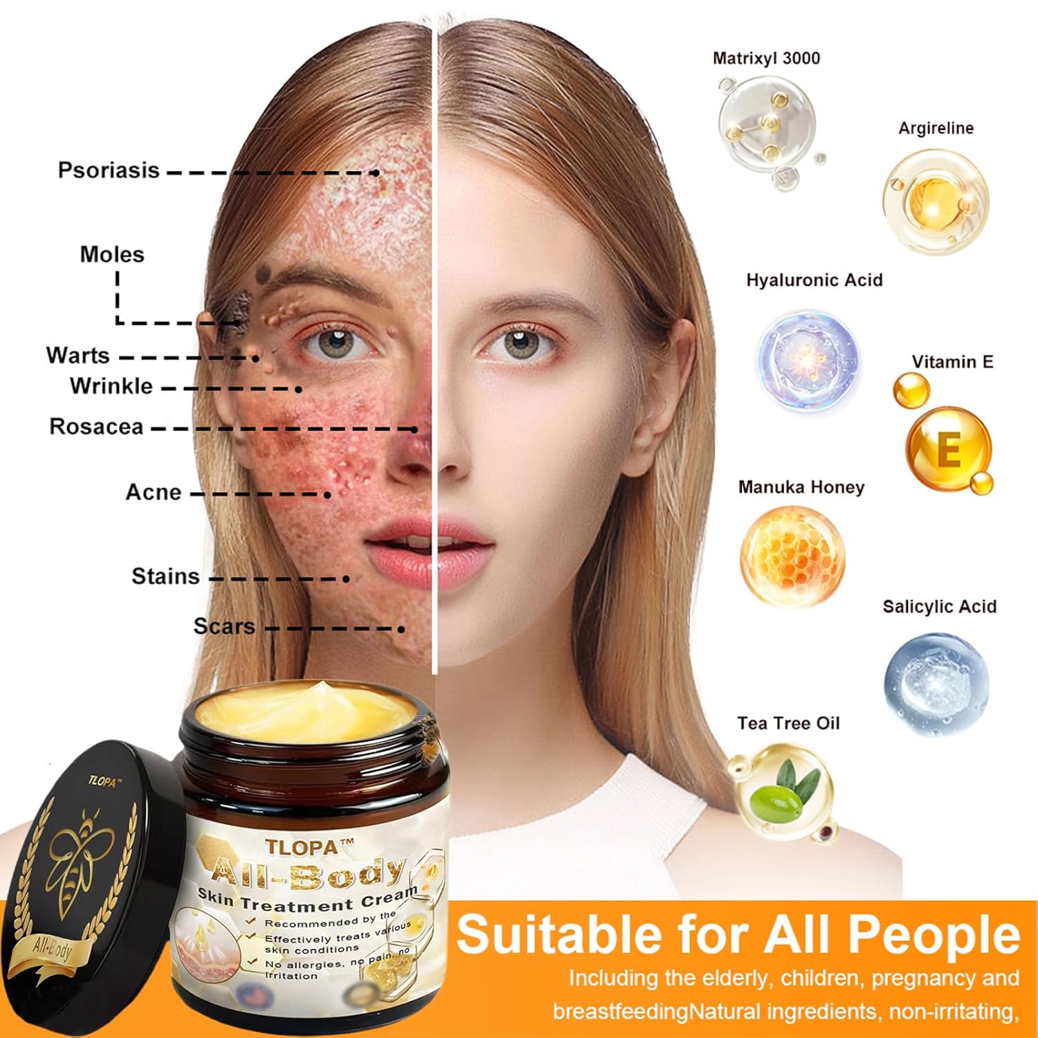 TLOPA Powerful All-Body Skin Treatment Cream, 2025 New Professional Bee Venom Cream, TLOPA Bee Venom Skin Treatment cream-50g for All Types (2 Bottle)