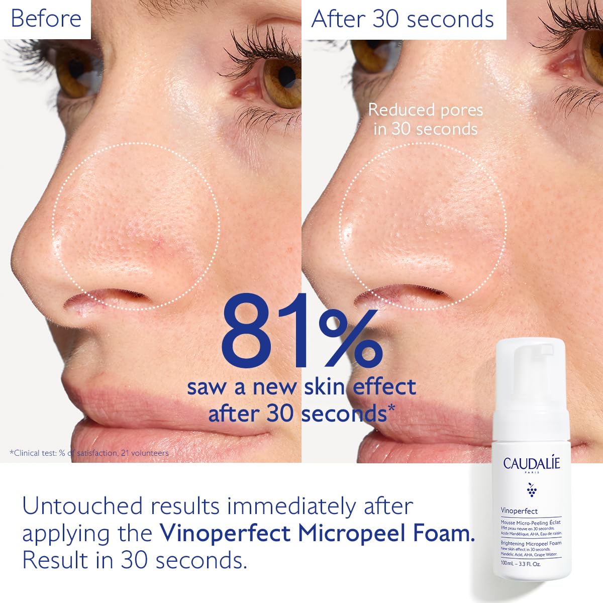 Caudalie Vinoperfect Brightening Micropeel Foam 50mL, White - Image 4
