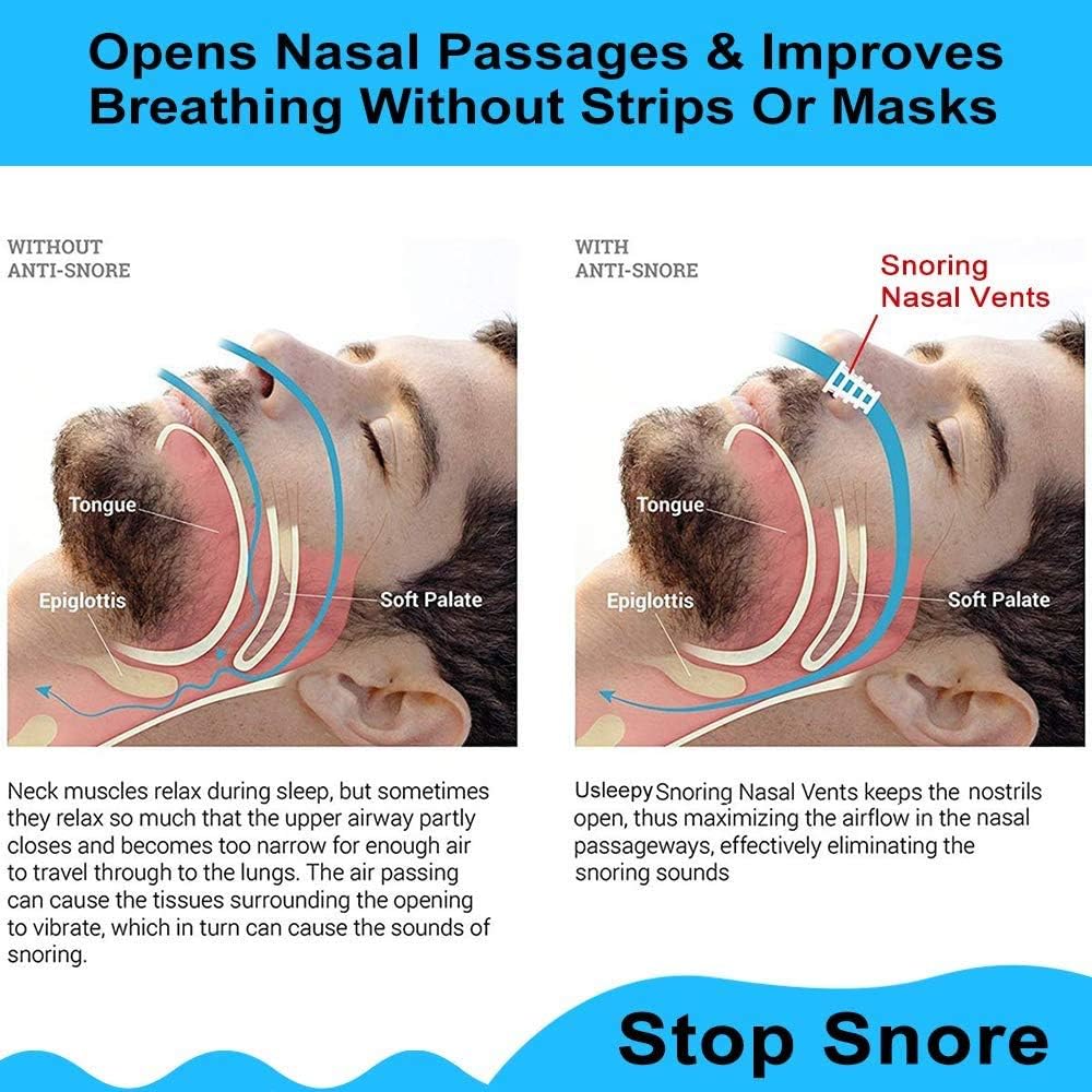 12 Pack Anti -Snoring Devices, Stop Snoring Nose Vents for Travel & Home Sleep Aid - Snore Solution Nasal Dilators, Ease Breathing, Healthy Sleeping Helper