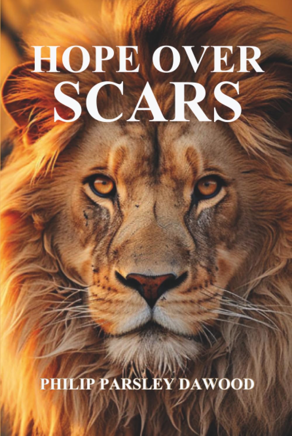 HOPE OVER SCARS: How God Turns Pain Into Purpose And Scars Into Testimonies