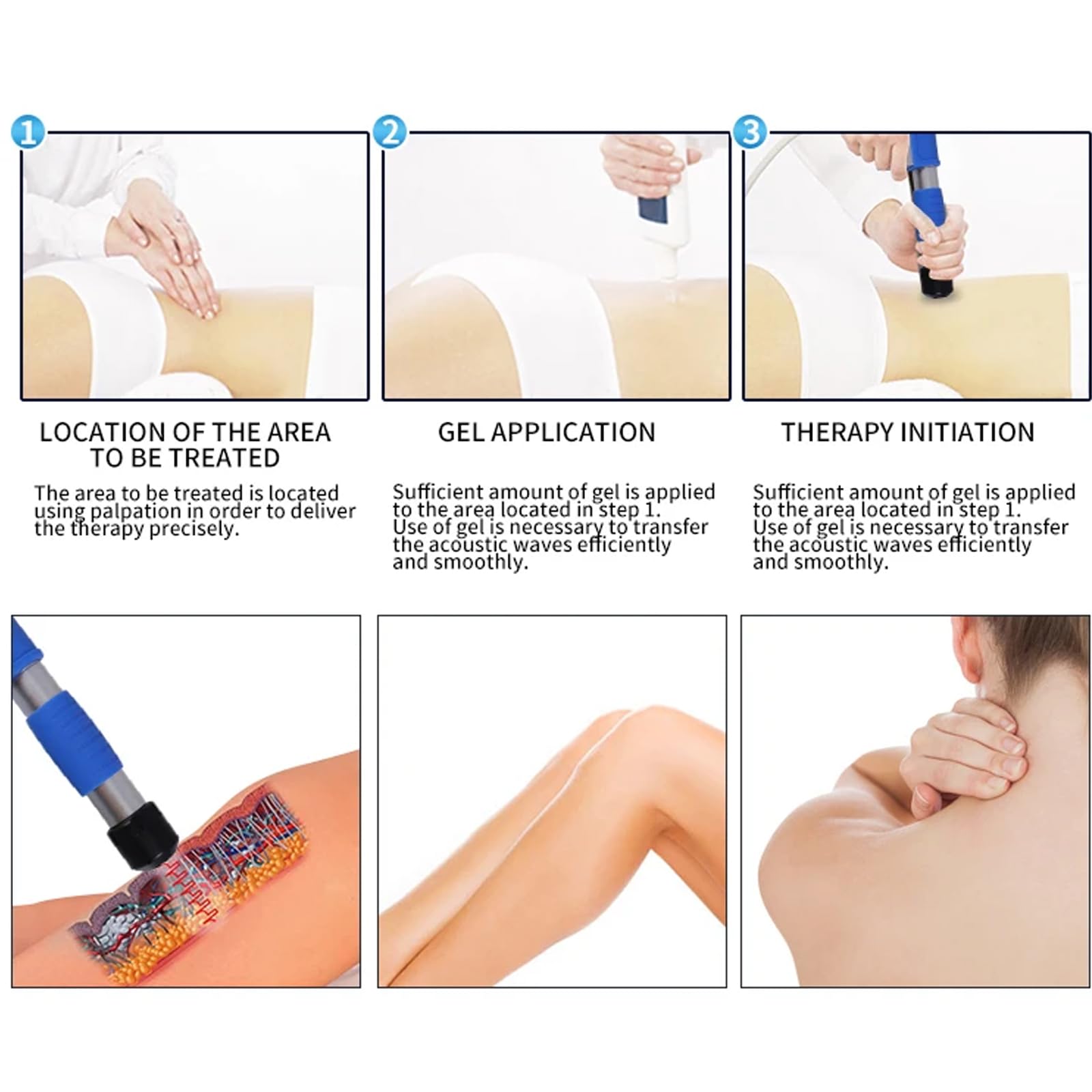 ESWT Shockwave ED Therapy Machine pozaustrojowa maszyna do terapii ED z 5 głowicami masującymi, do łagodzenia bólu stawów i mięśni, regeneracji mięśni i tkanek kostnych