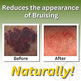 Relief Arnica Cream Natural Lotion for Effective Sore Muscle Relief | Arnica Bruise Cream with Lemongrass & Eucalyptus Essential Oils | Best Massage Lotion for Massage Therapy - 2 Pack