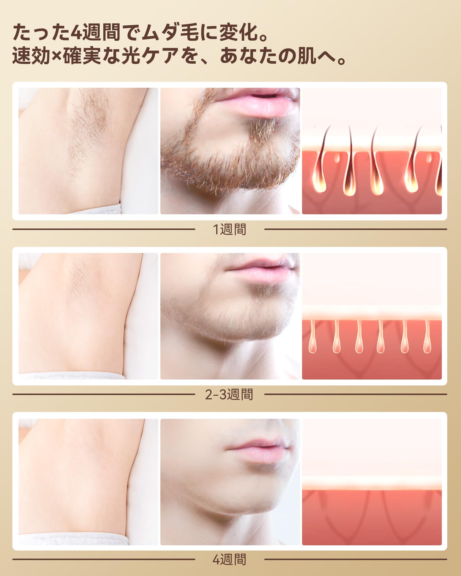 Amazon | YUNDOO 脱毛器 VIO対応【2025年新モデル・1台3役（HR/SC/RA