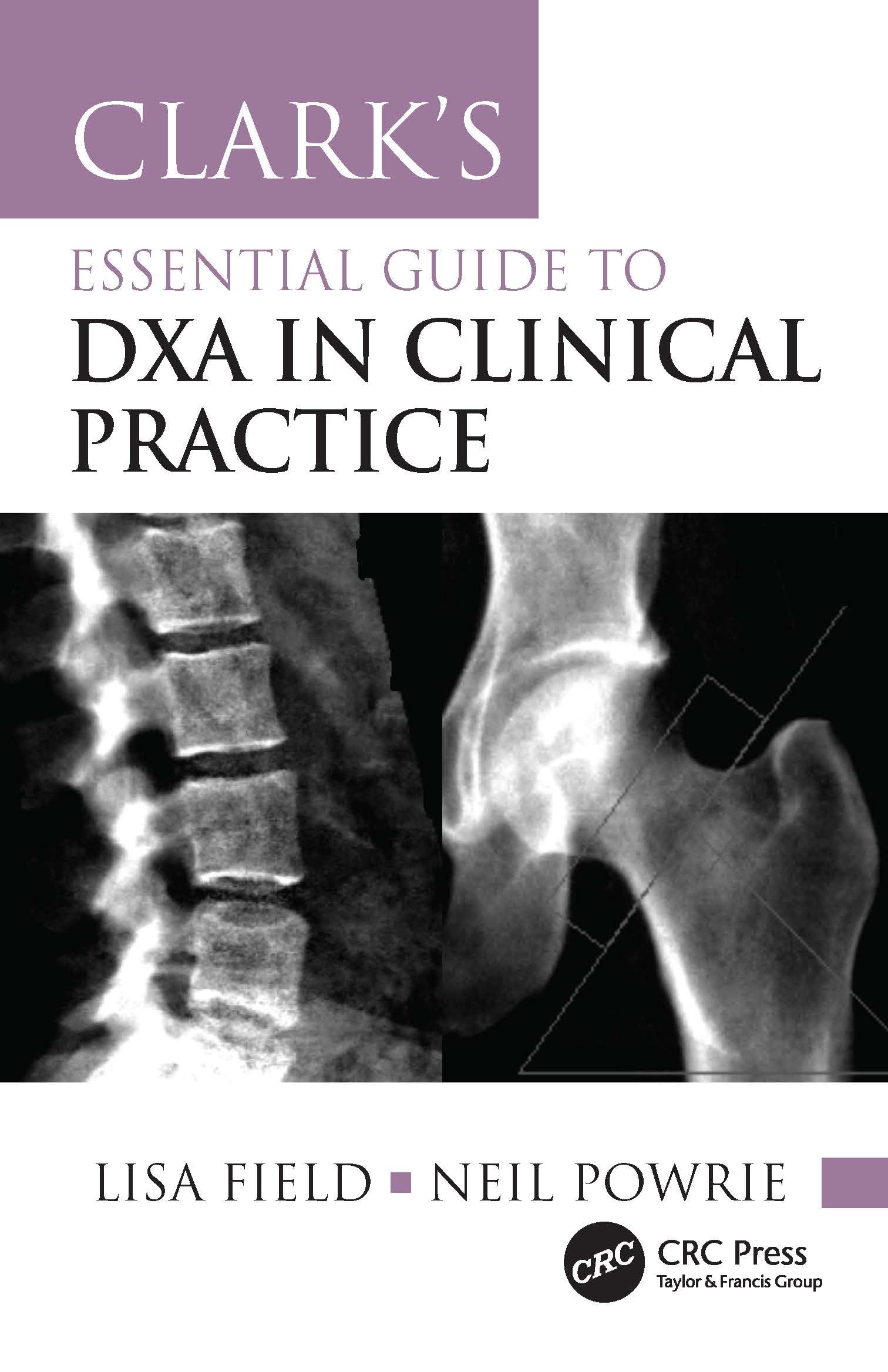 Clark's Essential Guide to DXA in Clinical Practice (Clark's Companion Essential Guides)