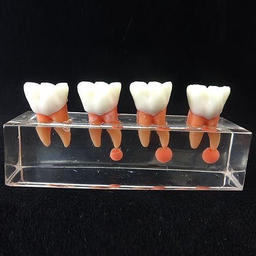 Miniatura 3 de Modelo de dientes dentales Modelo de tratamiento endodóntico de 4 etapas para estudiar y enseñar..