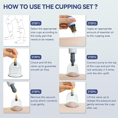 Vista 7 de KingPavonini Juego de terapia de ventosas de 24 tazas, juego profesional de ventosas chinas con magnético, ventosas al vacío portátiles