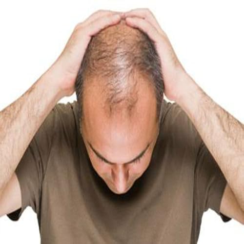 HAIR LOSS TREATMENT 100%