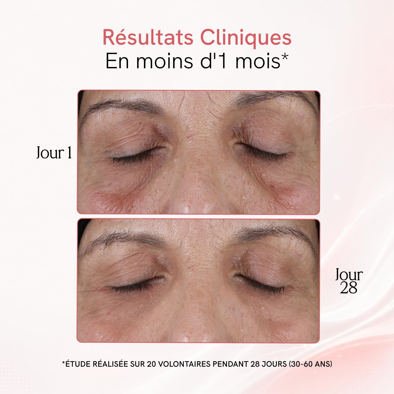 MASDERM Appareil de massage facial électrique 7 en 1 pour visage et corps Hifu - Haute fréquence esthétique - Indiba - Traitement